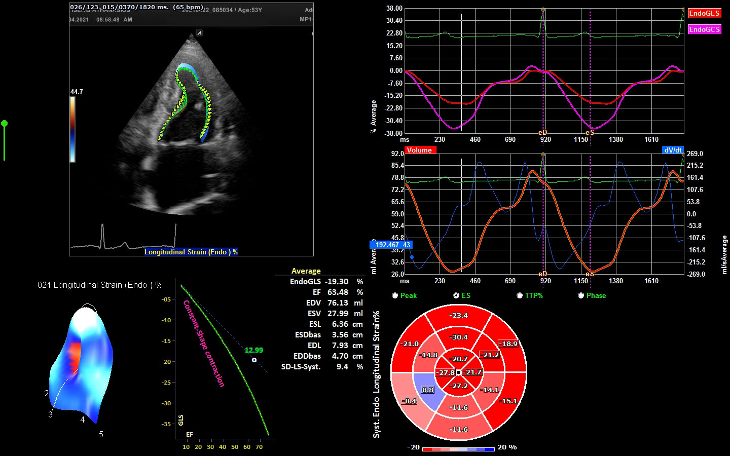 μελέτη ιστικης παραμορφωσης