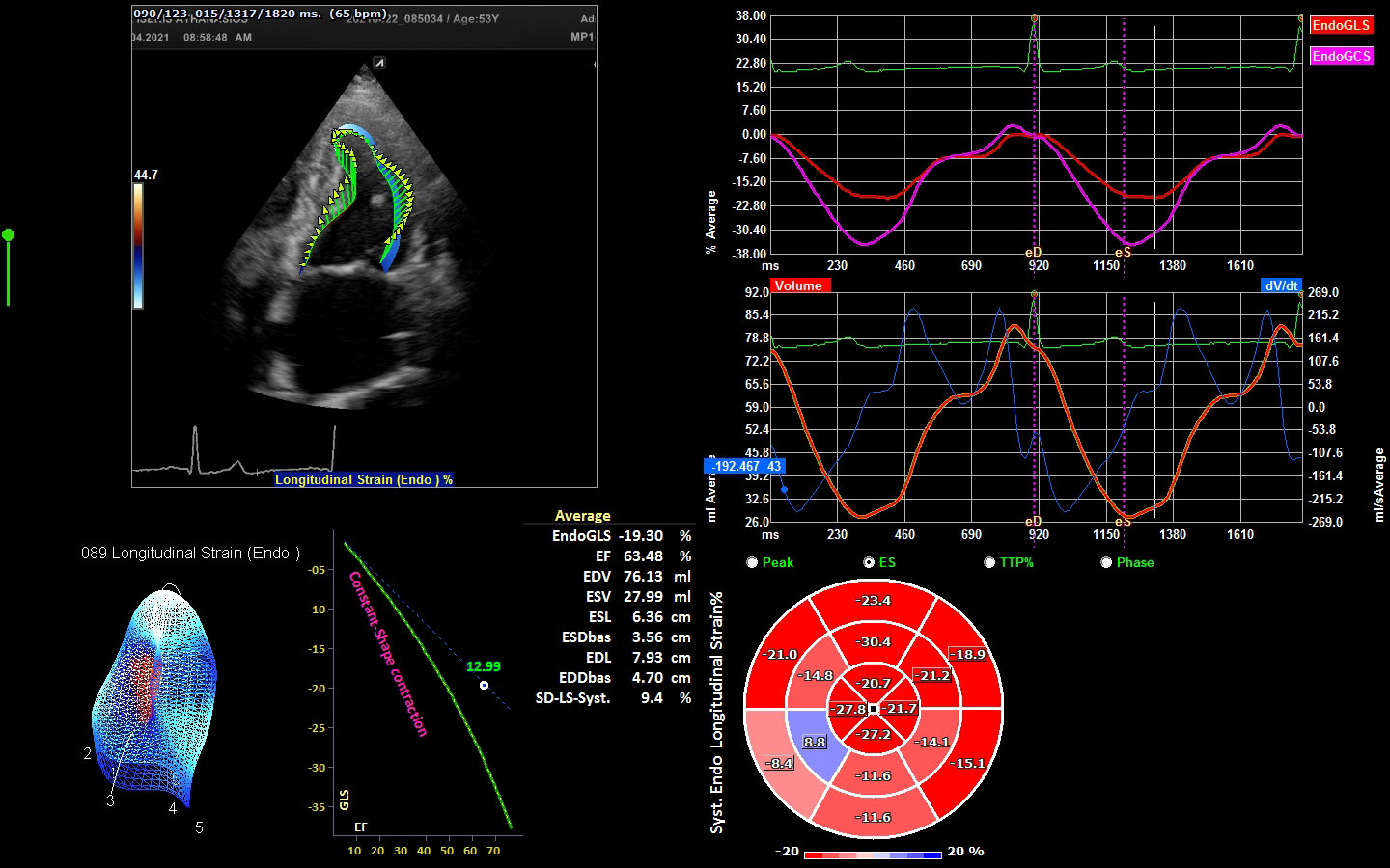 μελέτη ιστικης παραμορφωσης